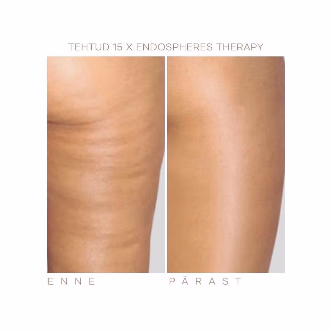 Näohooldused - Image Wrinkle Lift Forte