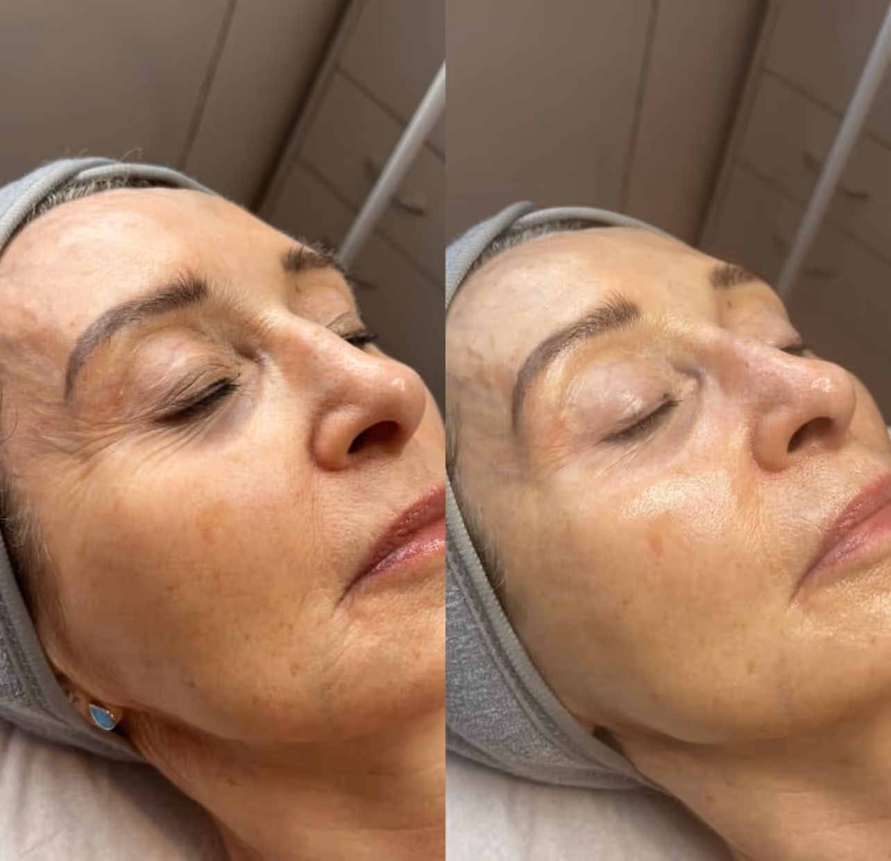 Näohooldused - Image Wrinkle Lift Forte