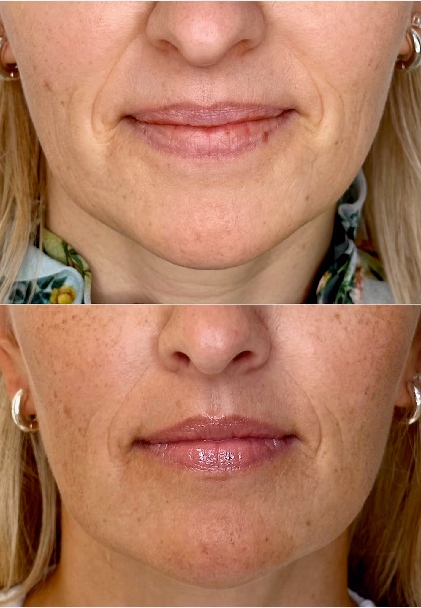 Näohooldused - Image Signature Lift